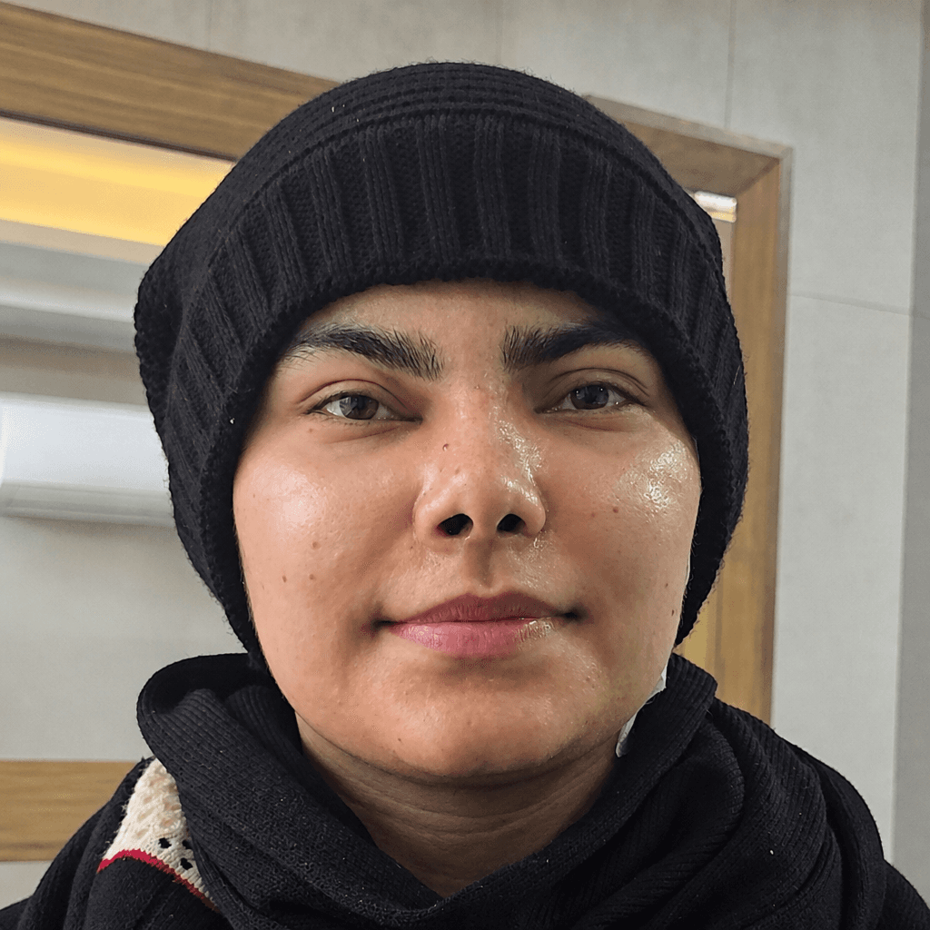بازسازی نواقص صورت — مورد 3 — بعد