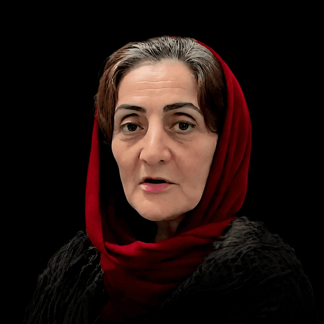 ایمپلنت — مورد 1 — قبل