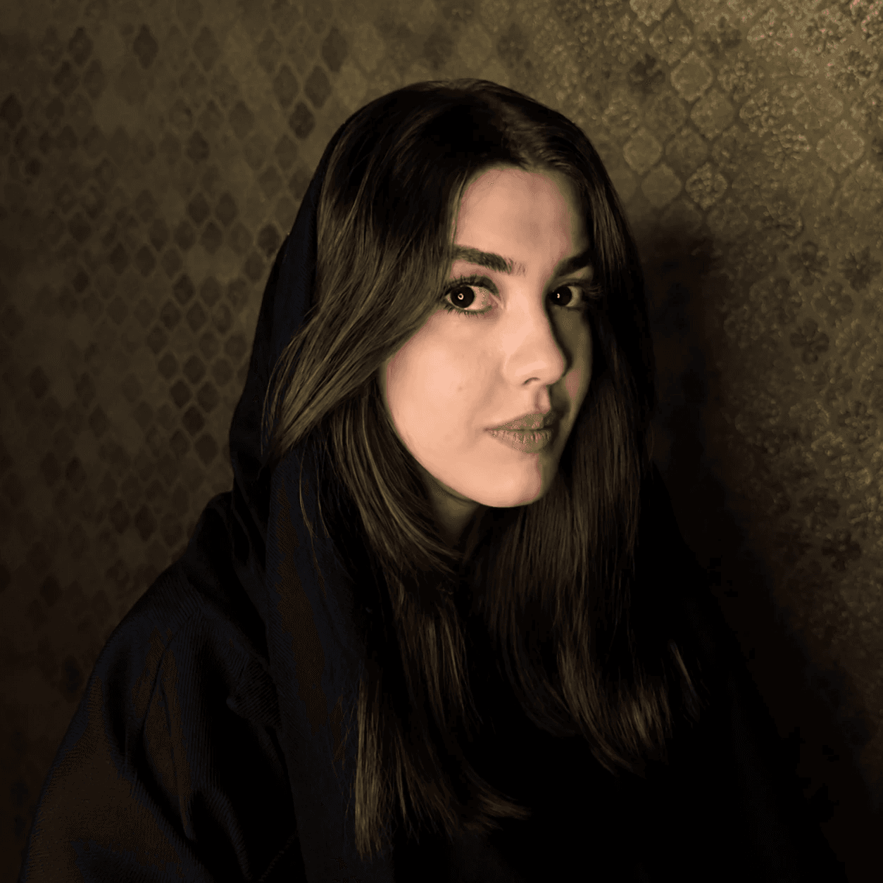 جراحی فک — مورد 8 — بعد