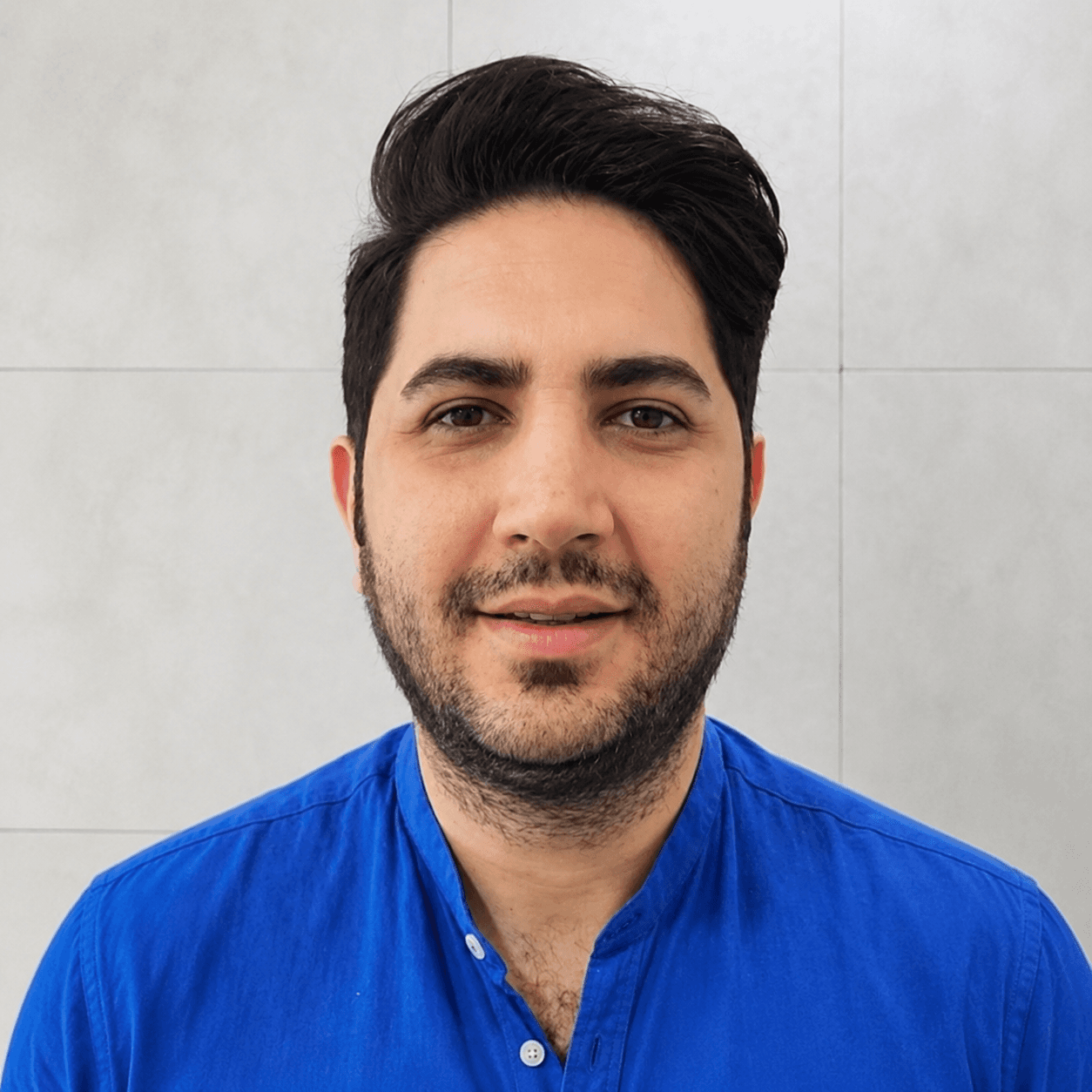 جراحی بینی — مورد 3 — بعد