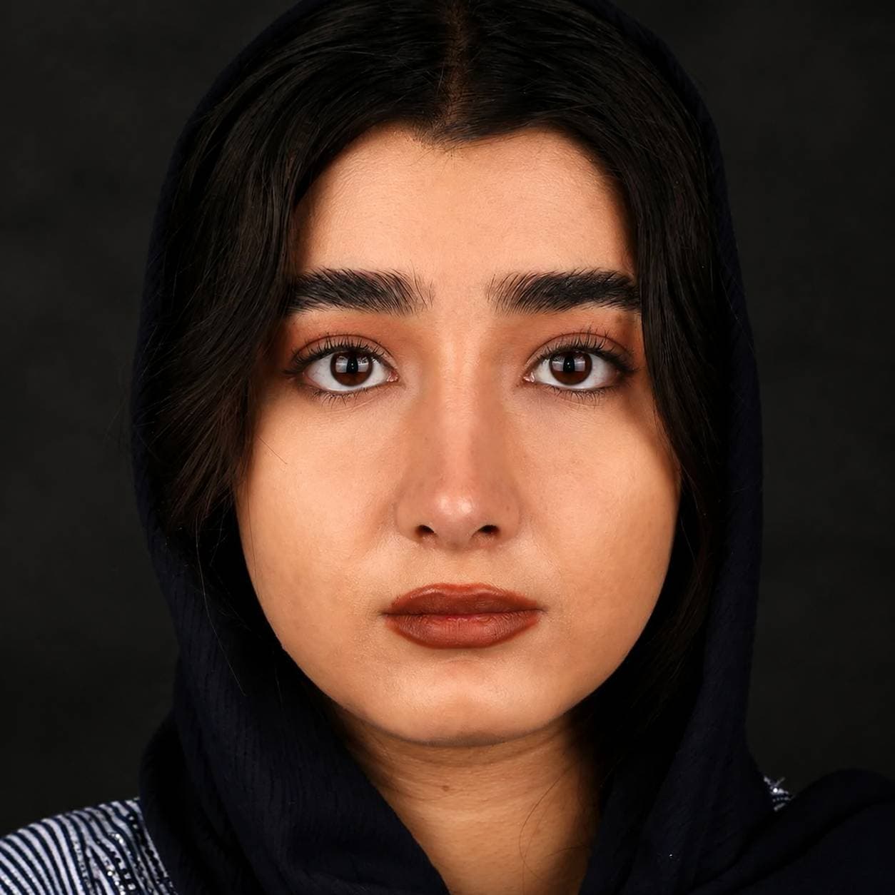 جراحی بینی — مورد 4 — بعد